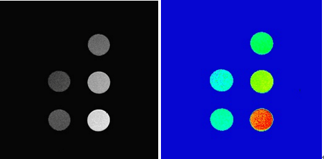 grayscale and pseudo color images of MRI contrast agent