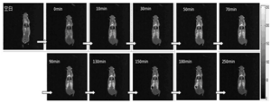 3. The effect evaluation of MRI contrast agent in vivo