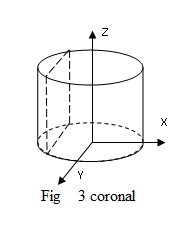 Coronal