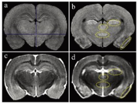Small Animal MRI System in Evaluation of Brain Injury in Rats