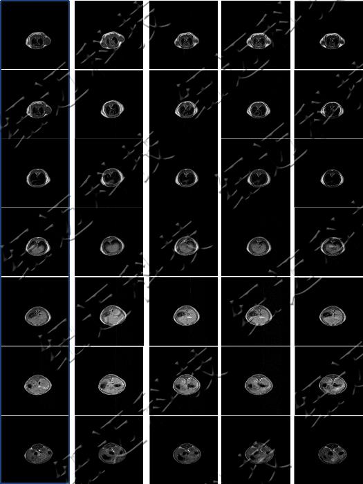 Low Field NMR Technique in Contrast Agent and Animal Imaging