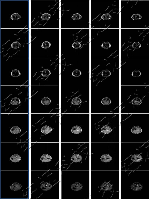 Applications of Low-Field NMR Technology in Contrast Agents and Animal Imaging