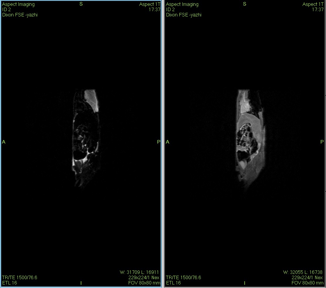 Fat Suppression Technique Using Dixon Sequence for Water-Fat Separation MRI in Rats and Mice
